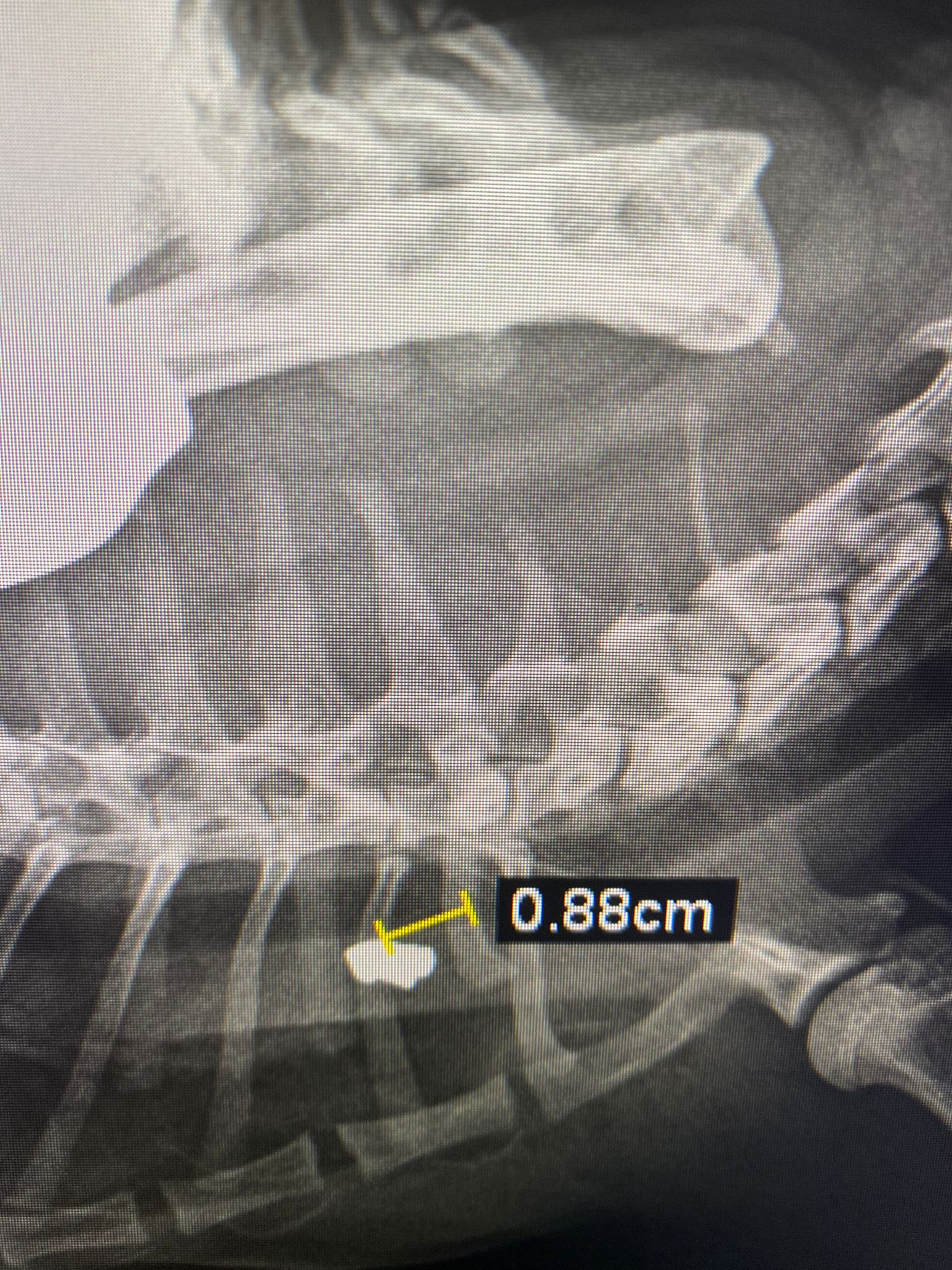 La gatta Pera ferita da un proiettile ad aria compressa - radiografia